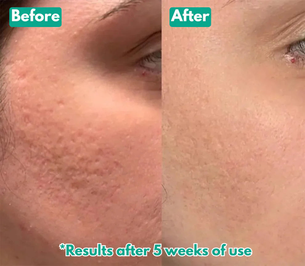 Microcrystal™ Serum PM Duo
