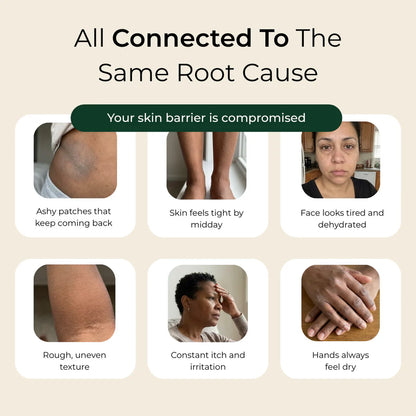 Pure Nilotica Shea Butter by NOVA™